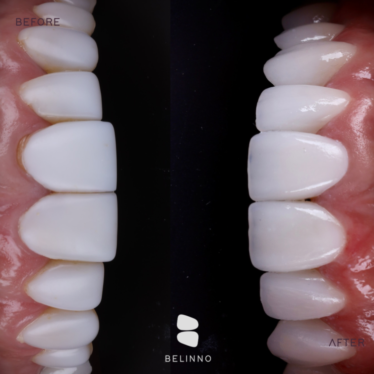 Before after minimal skincare Instagram post