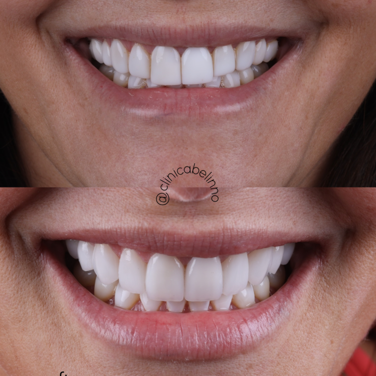 Nuestro caso de hoy, esperen los resultados